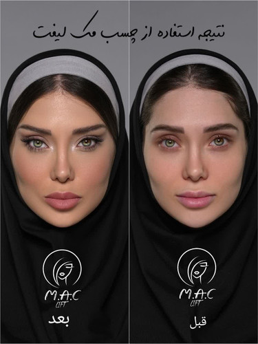 پک ویژه۶۶عددی چسب لیفت صورت ماندگاری 20 ساعته